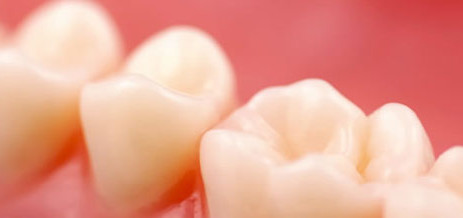 fillings4