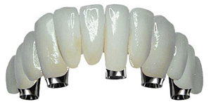 Dental implants - Implantcenter Hungary, Budapest