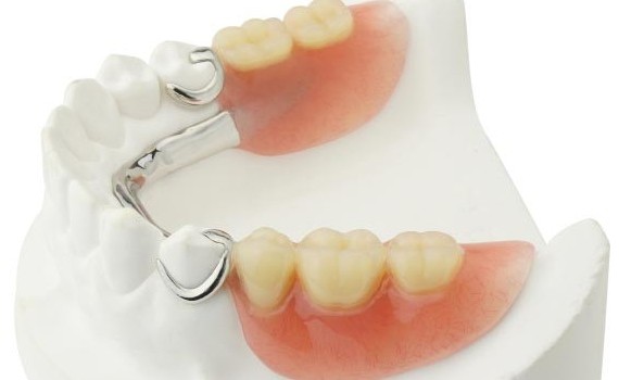 denture-dental-prosthesis-04